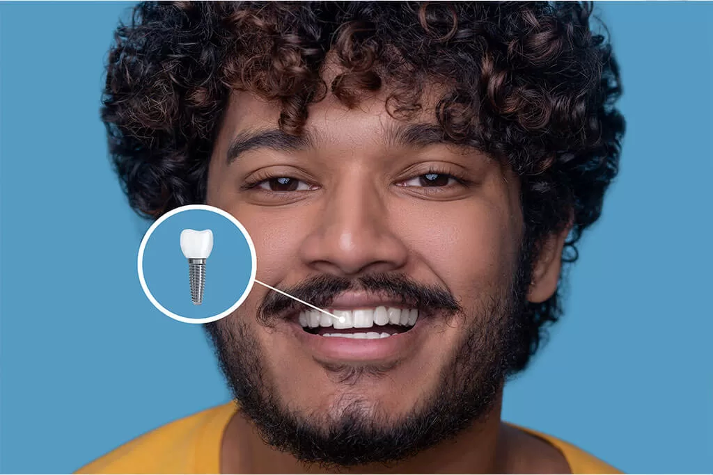 Homem sorrindo com ícone de implante dentário sobreposto
