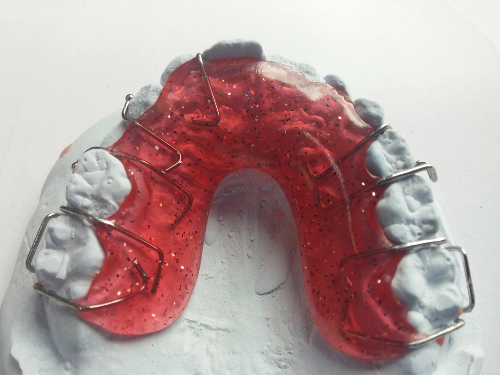 Aparelho ortodôntico sobre modelo de gesso