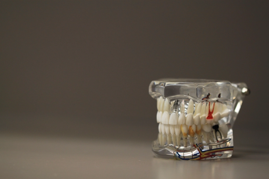 Modelo didático de arcada dentária sobre bancada, usado para explicar o tratamento de canal