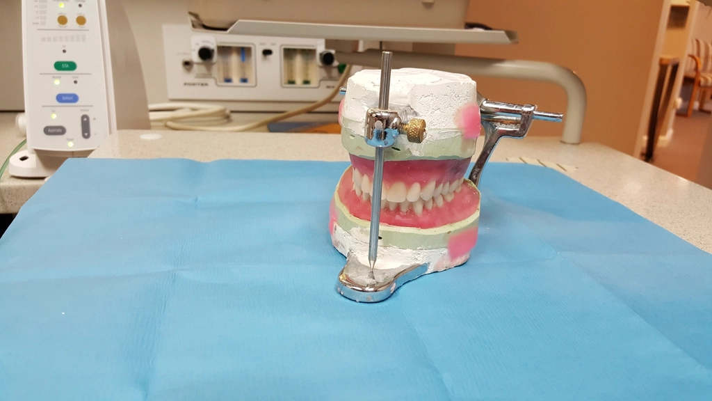 Modelos de gesso montados em articulador odontológico